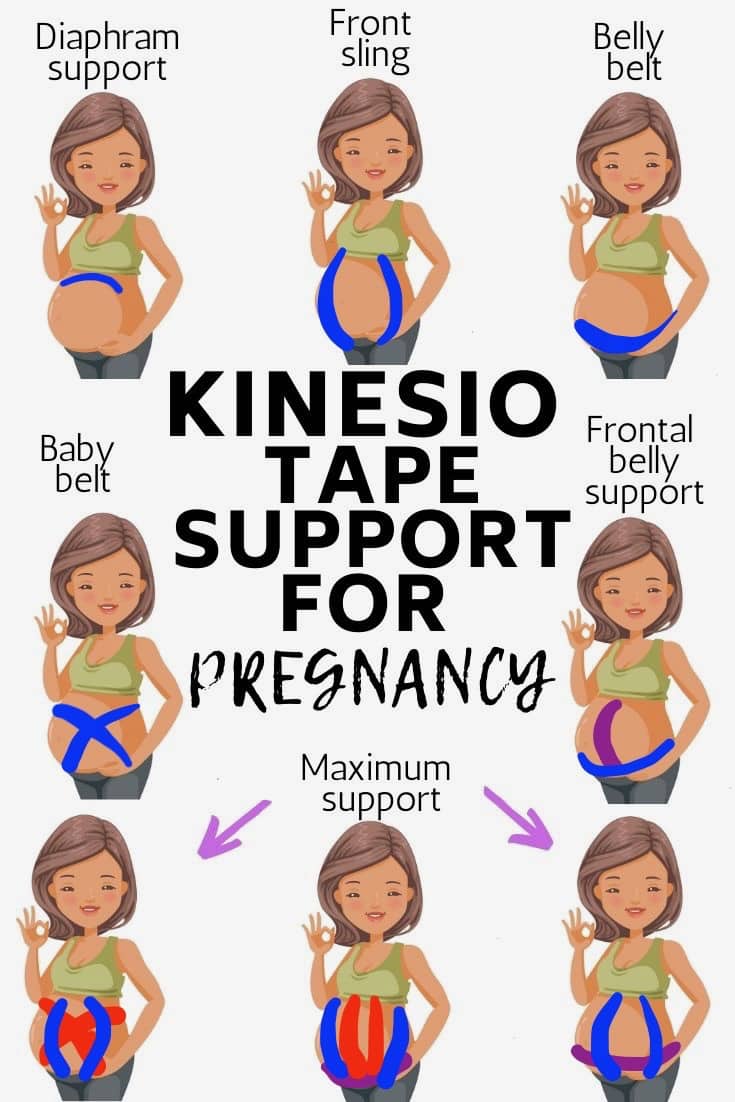 Need some belly support during pregnancy, try kinesiology tape! Mine i, pregnancy